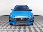 2018 Hyundai Kona Ultimate